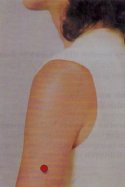Corpulentie en magneet therapie